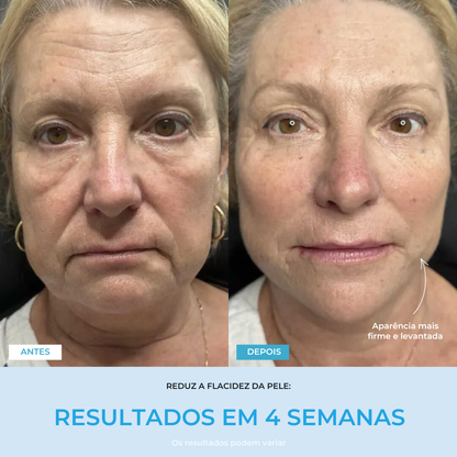 Liftlab — Modelador Facial Rejuvenescedor com Sérum Grátis