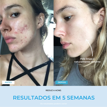 Liftlab — Modelador Facial Rejuvenescedor com Sérum Grátis