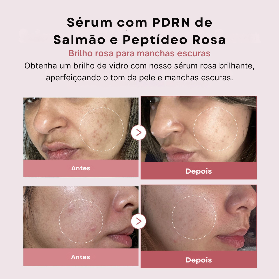 Sérum PDRN de Peptídeos Rosa