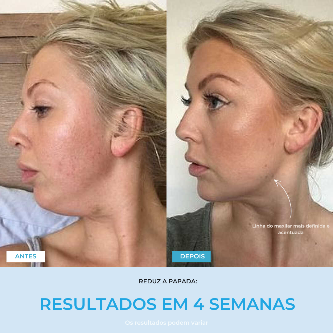 Liftlab — Modelador Facial Rejuvenescedor com Sérum Grátis