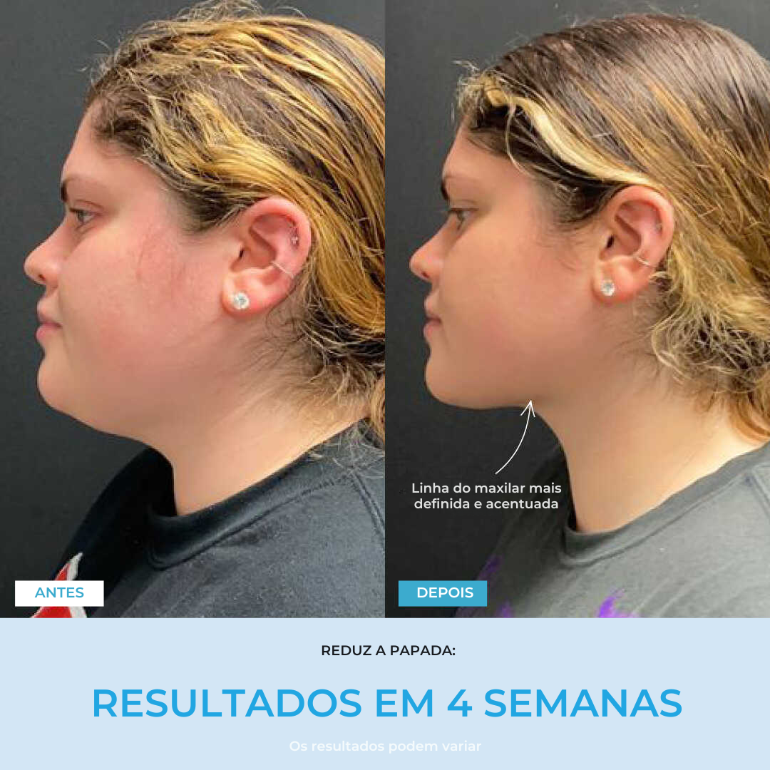Liftlab — Modelador Facial Rejuvenescedor com Sérum Grátis