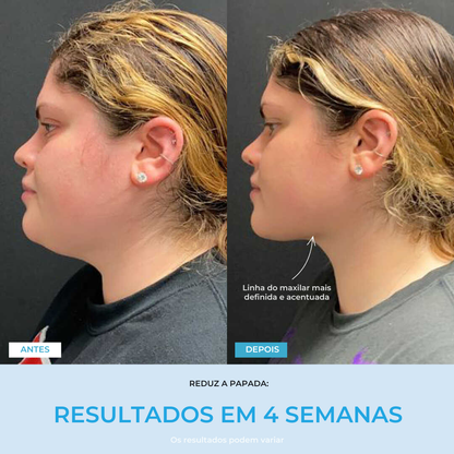 Liftlab — Modelador Facial Rejuvenescedor com Sérum Grátis