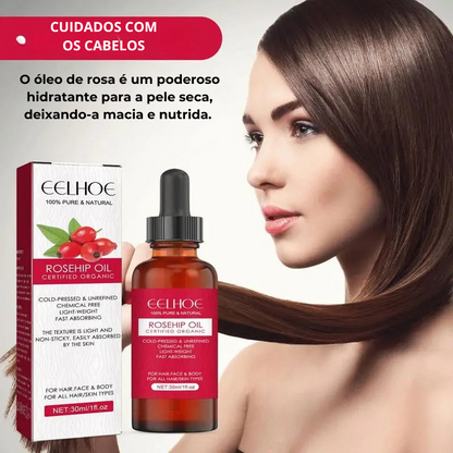 Óleo de Rosa Mosqueta Puro – Hidratação, Renovação e Brilho Natural